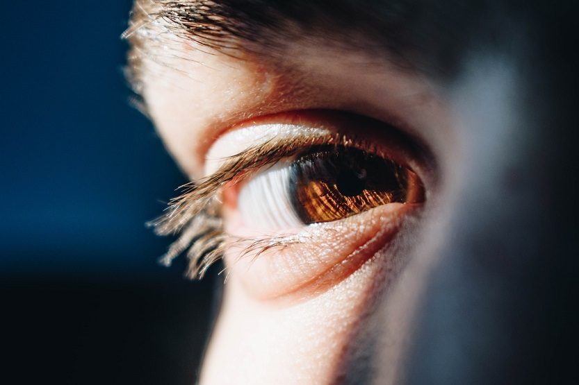 En este momento estás viendo Lentes ICL o lentes fáquicas