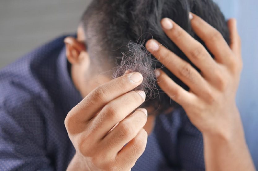 Lee más sobre el artículo Minoxidil, entre los productos más eficaces para combatir la pérdida del cabello